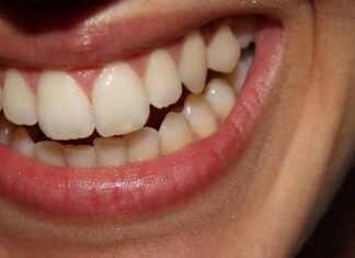 Má postura inibe riso, que faz bem ao coração e para pressão