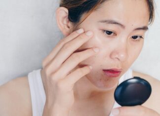 Veja como remover cravos: eliminá-los nunca foi tão fácil