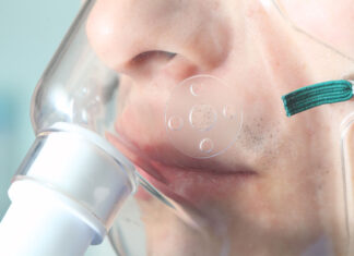 Defendida por Bolsonaro, nebulização de cloroquina mata três no RS