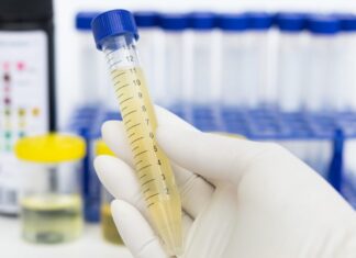 Fapesp: startup desenvolve teste rápido para o diagnóstico de câncer de bexiga