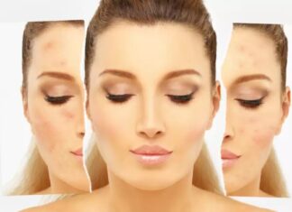 Dez benefícios do bicarbonato de sódio para sua pele Dez benefícios do bicarbonato de sódio para sua pele