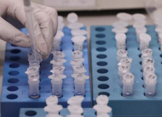 UFRJ desenvolve teste de baixo custo para detecção de Covid-19 UFRJ desenvolve teste de baixo custo para detecção de Covid-19