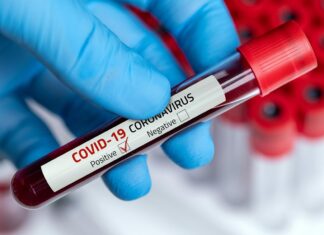 Rio Claro fecha agosto com queda de 50% nos casos de Covid Rio Claro fecha agosto com queda de 50% nos casos de Covid