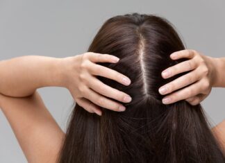 Três remédios caseiros fáceis para couro cabeludo oleoso Três remédios caseiros fáceis para couro cabeludo oleoso