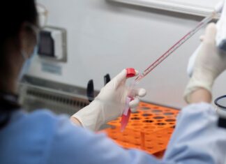 Rio Claro registra 18 novos casos de Covid-19 em 24 horas Rio Claro registra 18 novos casos de Covid-19 em 24 horas