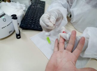 Cras Brasília realiza testes rápidos de Covid-19 nesta segunda Cras Brasília realiza testes rápidos de Covid-19 nesta segunda