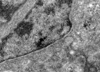 Pesquisa detecta coronavírus pela análise de retina Pesquisa detecta coronavírus pela análise de retina