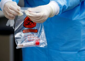 Rio Claro tem 15 novos casos de Covid-19 em 24 horas Rio Claro tem 15 novos casos de Covid-19 em 24 horas