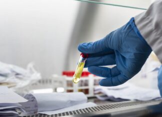 Rio Claro registra dez novos casos de Covid-19 e soma 19.068 infecções Rio Claro registra dez novos casos de Covid-19 e soma 19.068 infecções