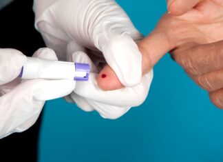 Rio Claro tem nove novos casos de Covid-19 e total de 18.962 infecções Rio Claro tem nove novos casos de Covid-19 e total de 18.962 infecções