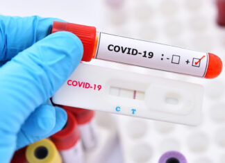 Rio Claro confirma 11 novos casos de Covid-19 Rio Claro confirma 11 novos casos de Covid-19