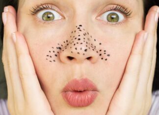 Duas maneiras fáceis e eficazes de remover cravos em casa Duas maneiras fáceis e eficazes de remover cravos em casa