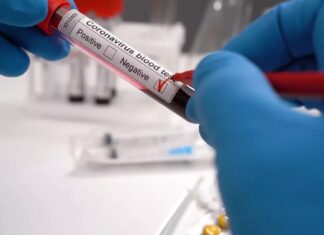 Rio Claro registra morte de idoso e 41 novos casos de Covid-19 Rio Claro registra morte de idoso e 41 novos casos de Covid-19