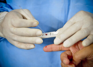 Brasil atinge 28,7 milhões de casos de Covid e 649,3 mil mortes Brasil atinge 28,7 milhões de casos de Covid e 649,3 mil mortes