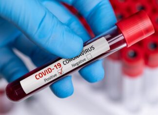 Rio Claro tem 2 mortes e 43 novos casos de Covid em 24 horas Rio Claro tem 2 mortes e 43 novos casos de Covid em 24 horas