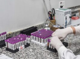 FMS terceiriza exames e promove desmanche de laboratório clínico